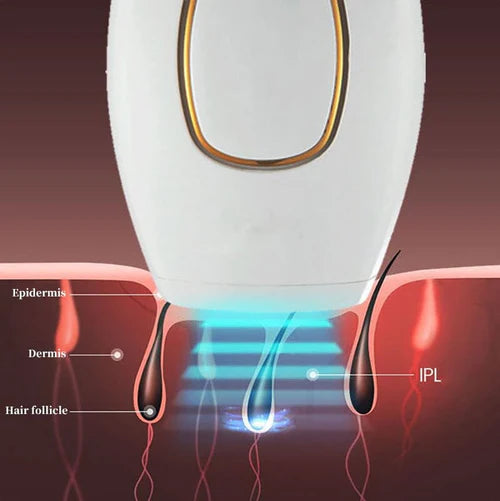 Depilador a Laser Definitivo Portátil - LaserDepil